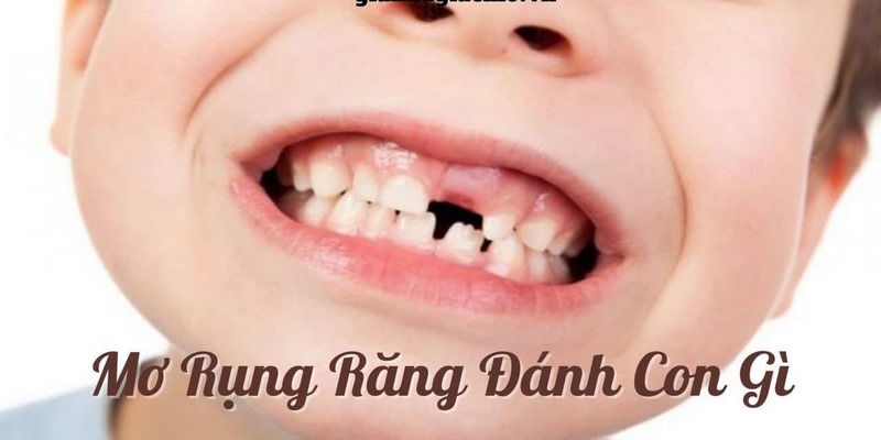 Nằm mơ thấy rụng răng cả hai hàm thể hiện những áp lực của bạn